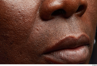 HD Face Skin Izik Wangombe cheek face lips mouth nose…